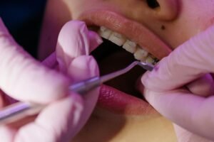 Dentists Seo